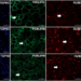 Obesidade, ansiedade e inflamações: entenda como suplemento de óleo de coco pode se tornar 'vilão' na dieta